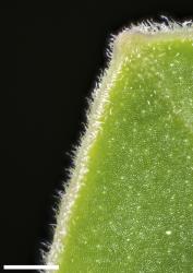 Veronica obtusata. Leaf margin hairs. Scale = 0.1 mm.
 Image: W.M. Malcolm © Te Papa CC-BY-NC 3.0 NZ